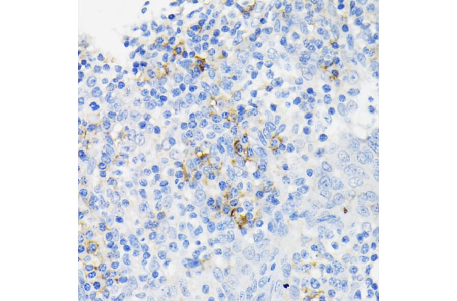 Immunohistochemistry - Anti-Cathelicidin/CLP Antibody (A11466) - Antibodies.com
