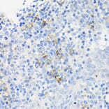 Immunohistochemistry - Anti-Cathelicidin/CLP Antibody (A11466) - Antibodies.com