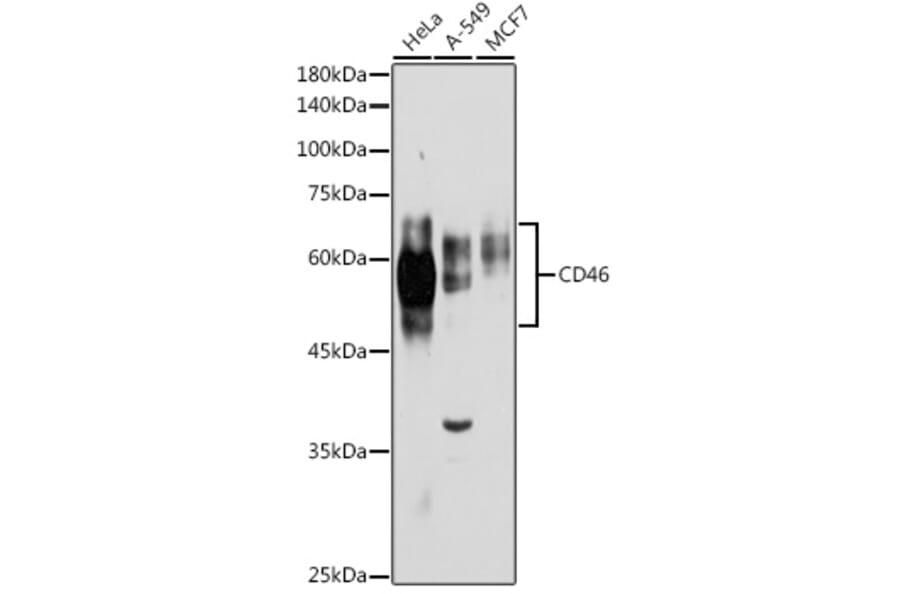 Western Blot - Anti-CD46 Antibody (A11467) - Antibodies.com