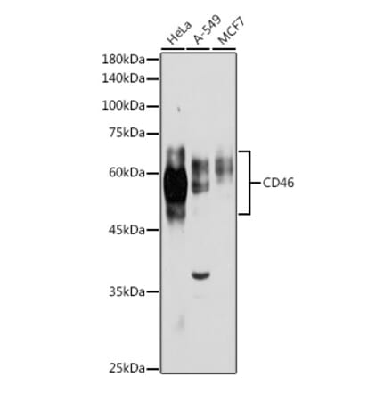 Western Blot - Anti-CD46 Antibody (A11467) - Antibodies.com