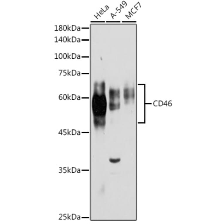 Western Blot - Anti-CD46 Antibody (A11467) - Antibodies.com