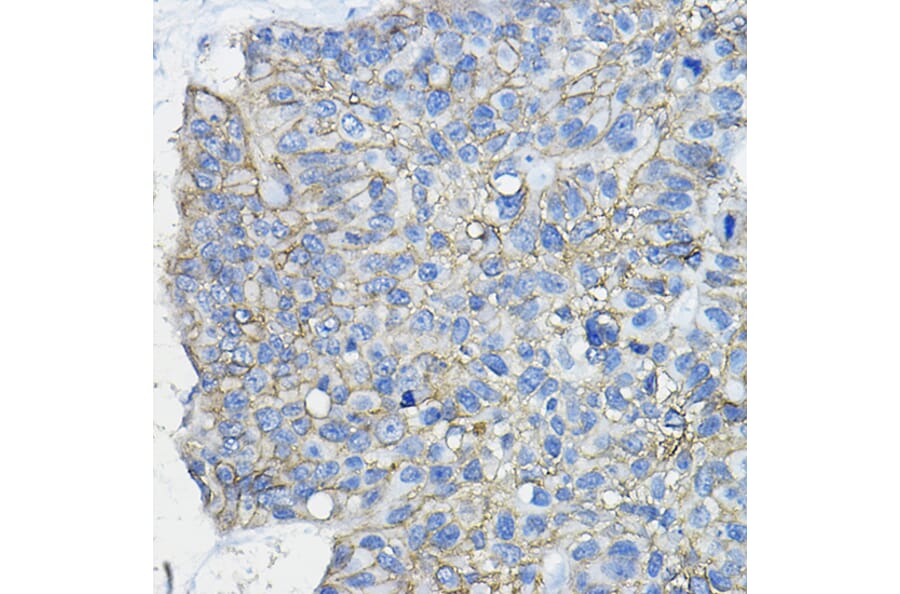 Immunohistochemistry - Anti-CD46 Antibody (A11467) - Antibodies.com
