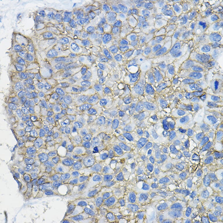 Immunohistochemistry - Anti-CD46 Antibody (A11467) - Antibodies.com