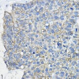 Immunohistochemistry - Anti-CD46 Antibody (A11467) - Antibodies.com