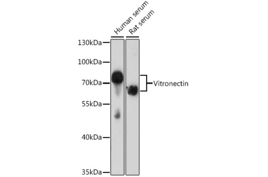 Western Blot - Anti-Vitronectin/S-Protein Antibody (A11468) - Antibodies.com