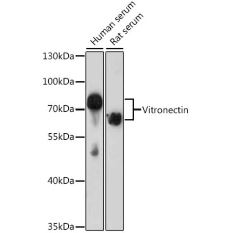 Western Blot - Anti-Vitronectin/S-Protein Antibody (A11468) - Antibodies.com