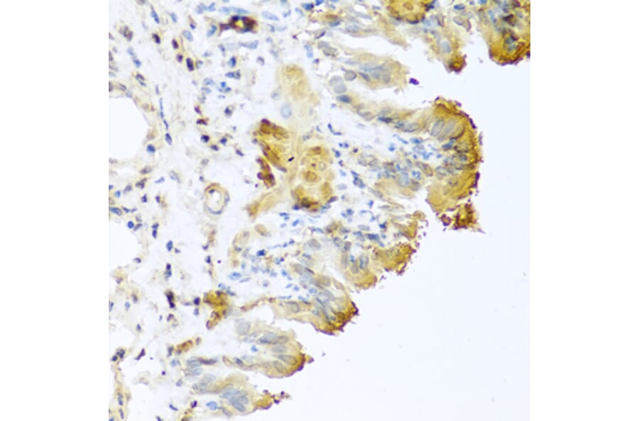 Immunohistochemistry - Anti-Vitronectin/S-Protein Antibody (A11468) - Antibodies.com