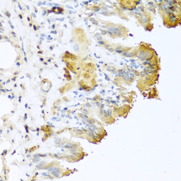 Immunohistochemistry - Anti-Vitronectin/S-Protein Antibody (A11468) - Antibodies.com