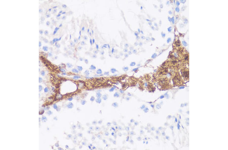 Immunohistochemistry - Anti-Vitronectin/S-Protein Antibody (A11468) - Antibodies.com