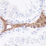 Immunohistochemistry - Anti-Vitronectin/S-Protein Antibody (A11468) - Antibodies.com