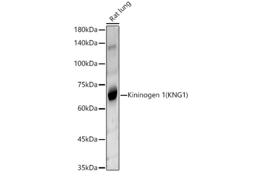 Western Blot - Anti-Kininogen 1 Antibody (A11469) - Antibodies.com