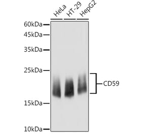 Western Blot - Anti-CD59 Antibody (A11470) - Antibodies.com