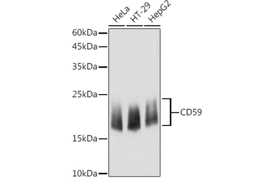 Western Blot - Anti-CD59 Antibody (A11470) - Antibodies.com