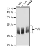 Western Blot - Anti-CD59 Antibody (A11470) - Antibodies.com