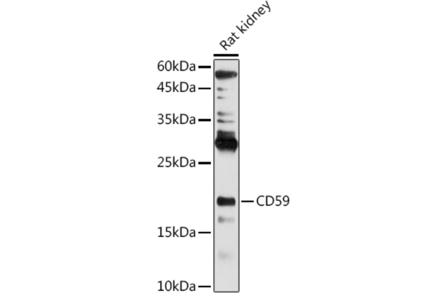 Western Blot - Anti-CD59 Antibody (A11470) - Antibodies.com