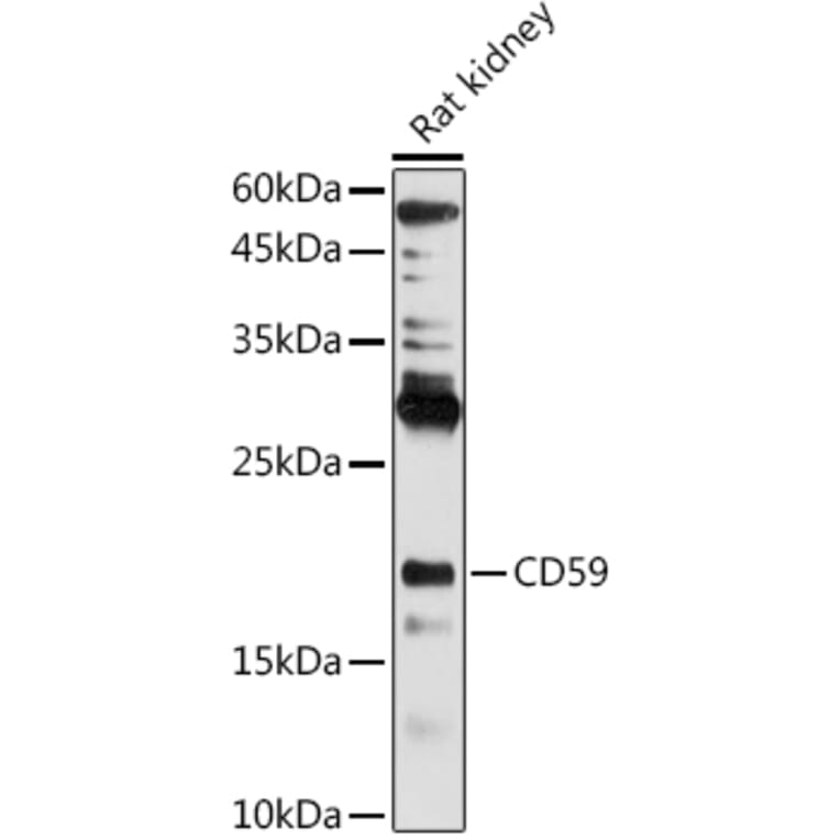 Western Blot - Anti-CD59 Antibody (A11470) - Antibodies.com