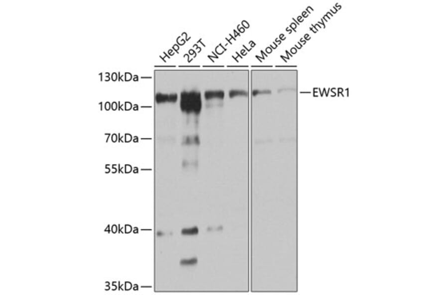 Western Blot - Anti-EWSR1 Antibody (A1690) - Antibodies.com
