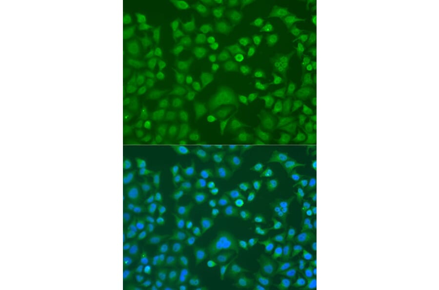 Immunofluorescence - Anti-EWSR1 Antibody (A1690) - Antibodies.com