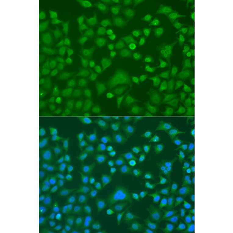 Immunofluorescence - Anti-EWSR1 Antibody (A1690) - Antibodies.com