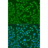 Immunofluorescence - Anti-EWSR1 Antibody (A1690) - Antibodies.com