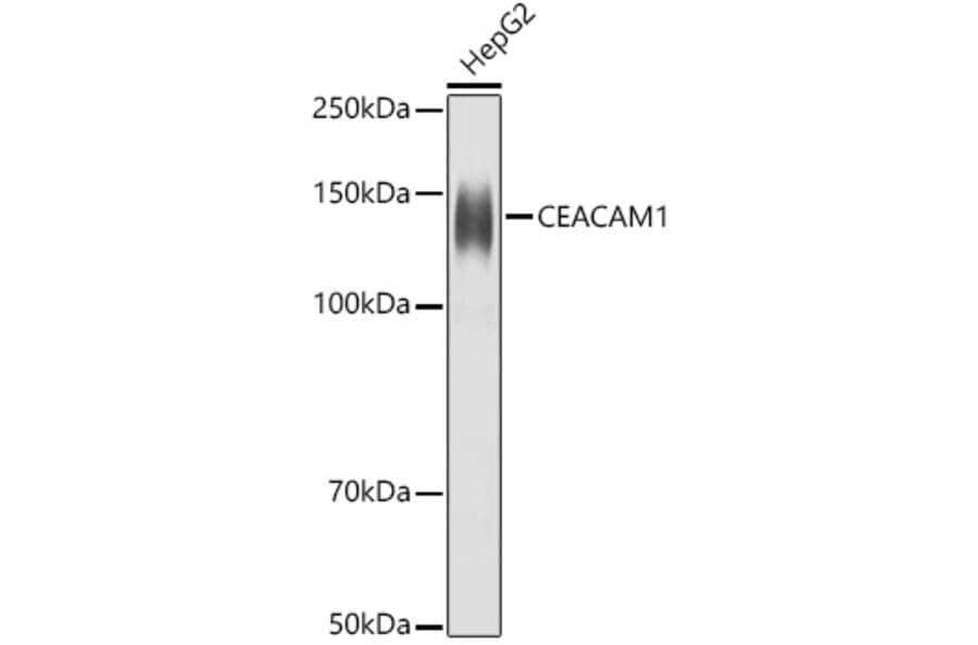 Western Blot - Anti-CEACAM1 Antibody (A11472) - Antibodies.com