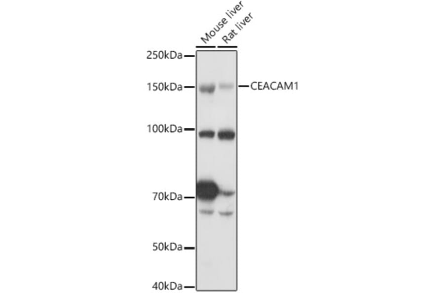 Western Blot - Anti-CEACAM1 Antibody (A11472) - Antibodies.com