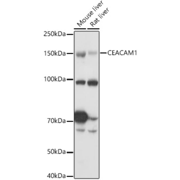 Western Blot - Anti-CEACAM1 Antibody (A11472) - Antibodies.com