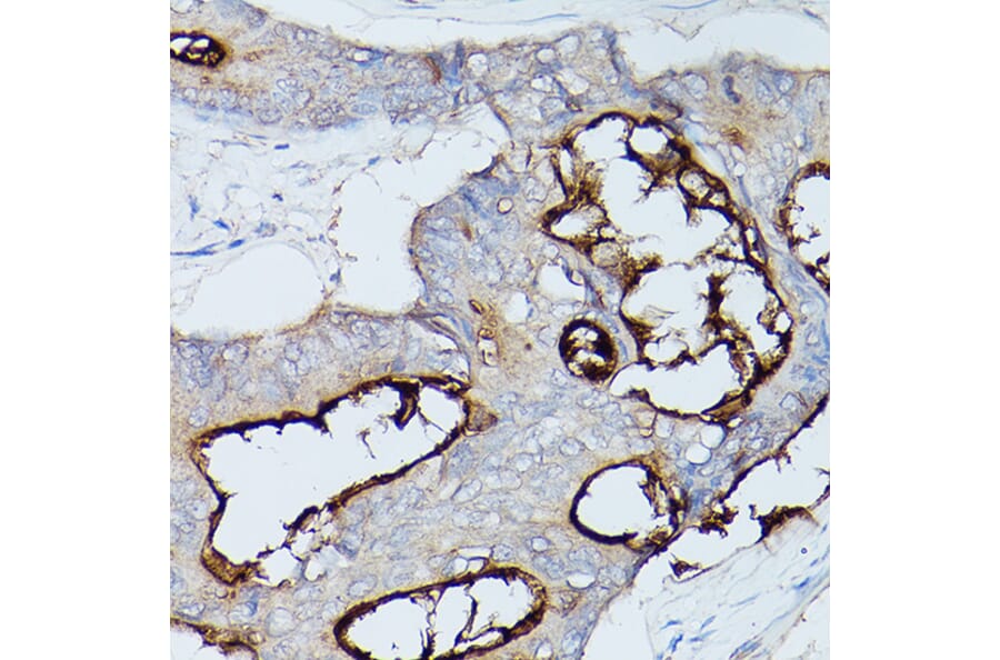Immunohistochemistry - Anti-CEACAM1 Antibody (A11472) - Antibodies.com