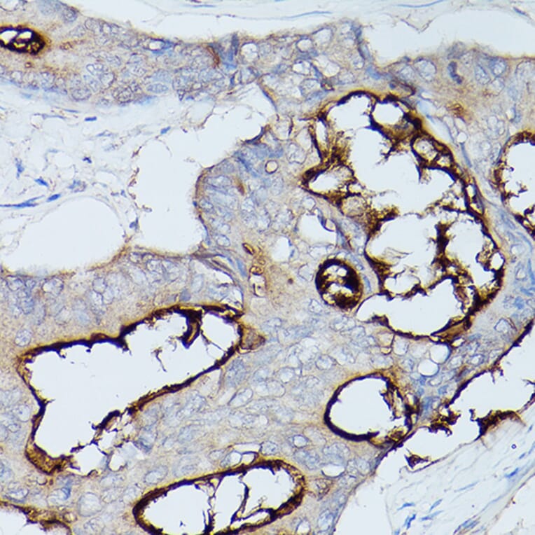 Immunohistochemistry - Anti-CEACAM1 Antibody (A11472) - Antibodies.com