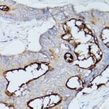 Immunohistochemistry - Anti-CEACAM1 Antibody (A11472) - Antibodies.com