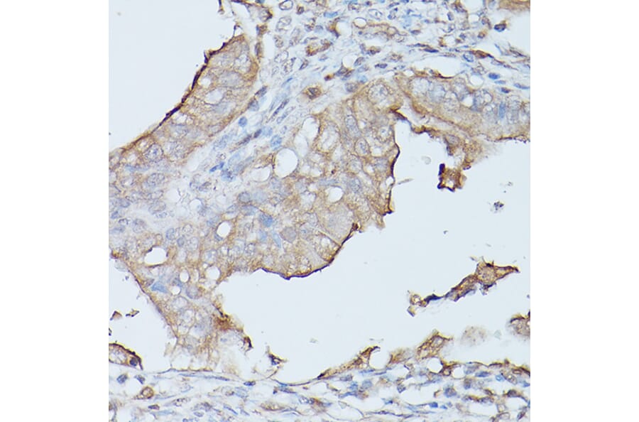 Immunohistochemistry - Anti-CEACAM1 Antibody (A11472) - Antibodies.com
