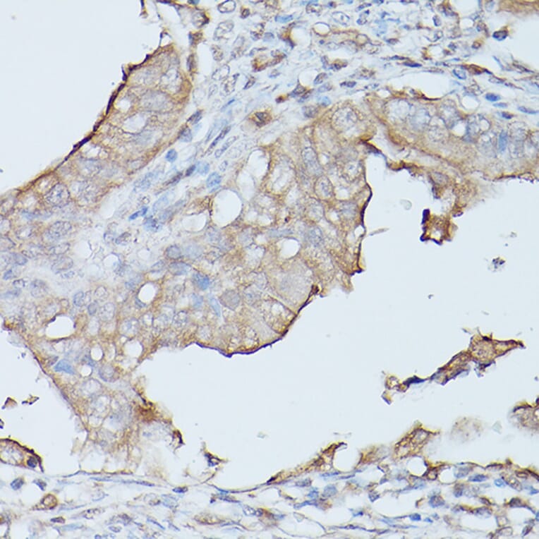 Immunohistochemistry - Anti-CEACAM1 Antibody (A11472) - Antibodies.com