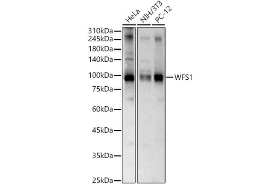 Western Blot - Anti-WFS1 Antibody (A11473) - Antibodies.com