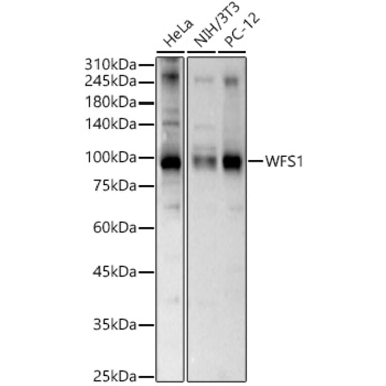 Western Blot - Anti-WFS1 Antibody (A11473) - Antibodies.com