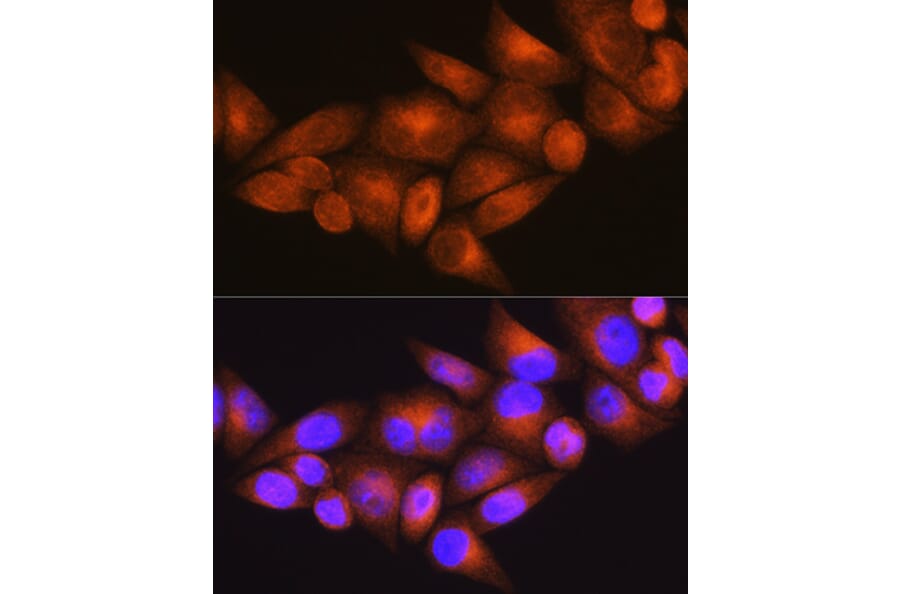 Immunofluorescence - Anti-WFS1 Antibody (A11473) - Antibodies.com