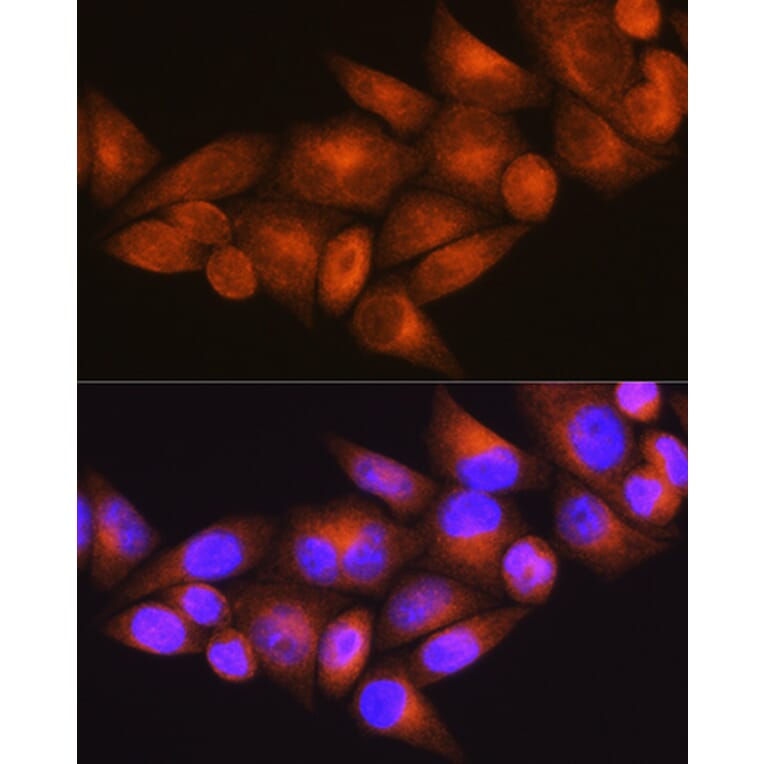 Immunofluorescence - Anti-WFS1 Antibody (A11473) - Antibodies.com