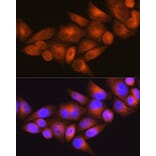 Immunofluorescence - Anti-WFS1 Antibody (A11473) - Antibodies.com