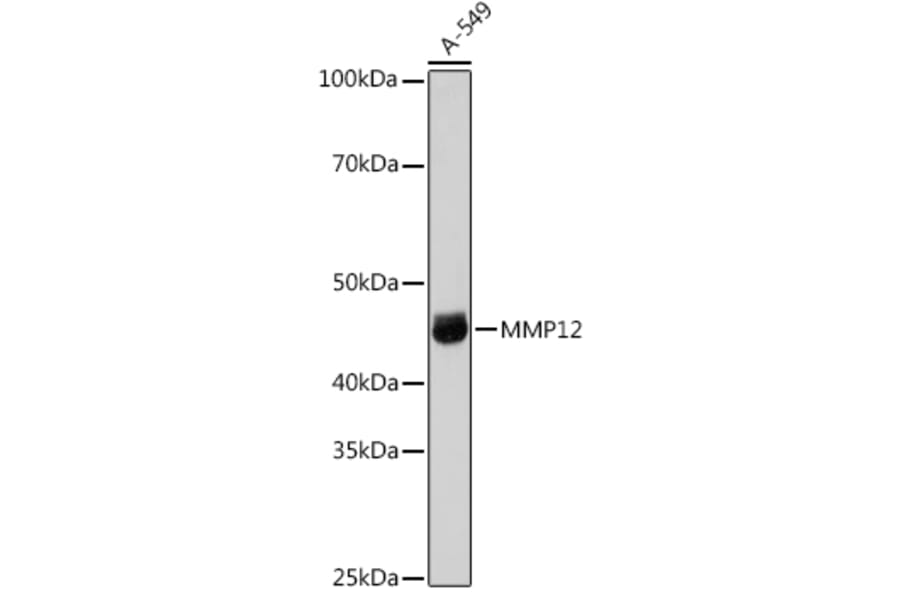 Western Blot - Anti-MMP12 Antibody (A11474) - Antibodies.com