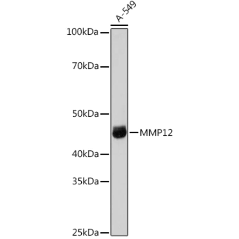 Western Blot - Anti-MMP12 Antibody (A11474) - Antibodies.com