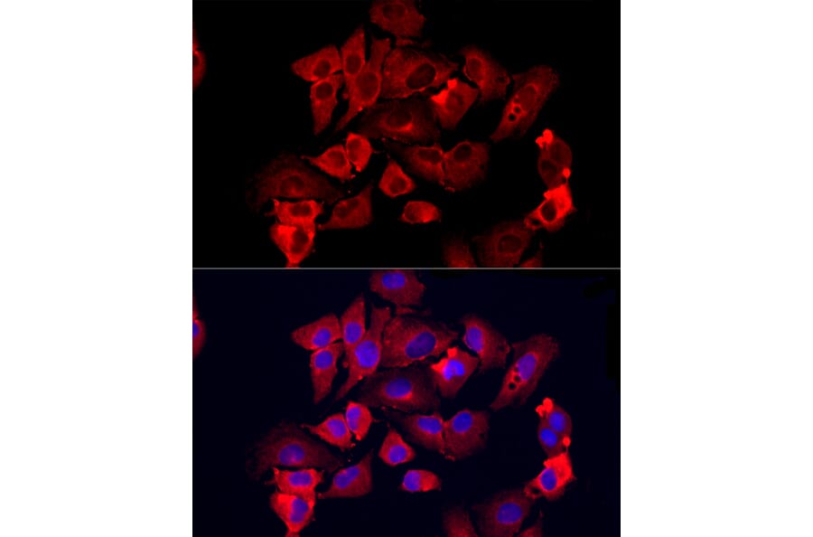 Immunofluorescence - Anti-MMP12 Antibody (A11474) - Antibodies.com