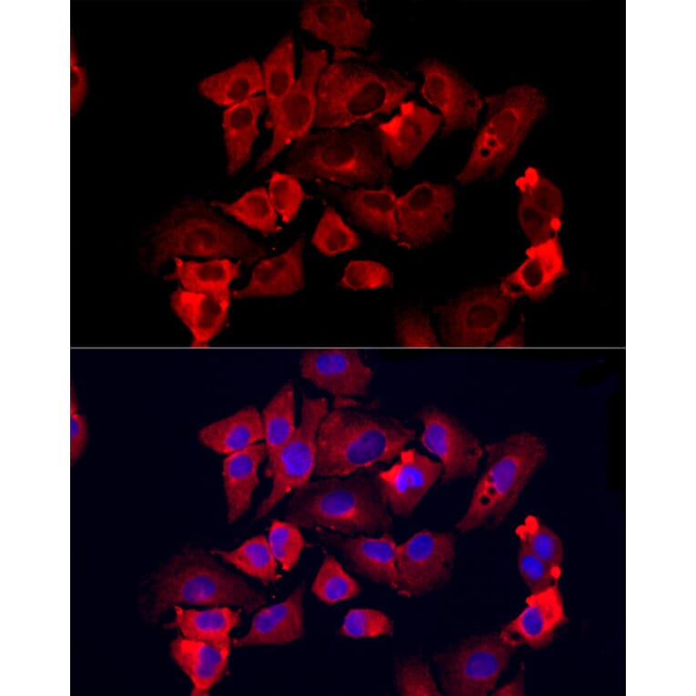 Immunofluorescence - Anti-MMP12 Antibody (A11474) - Antibodies.com