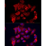 Immunofluorescence - Anti-MMP12 Antibody (A11474) - Antibodies.com