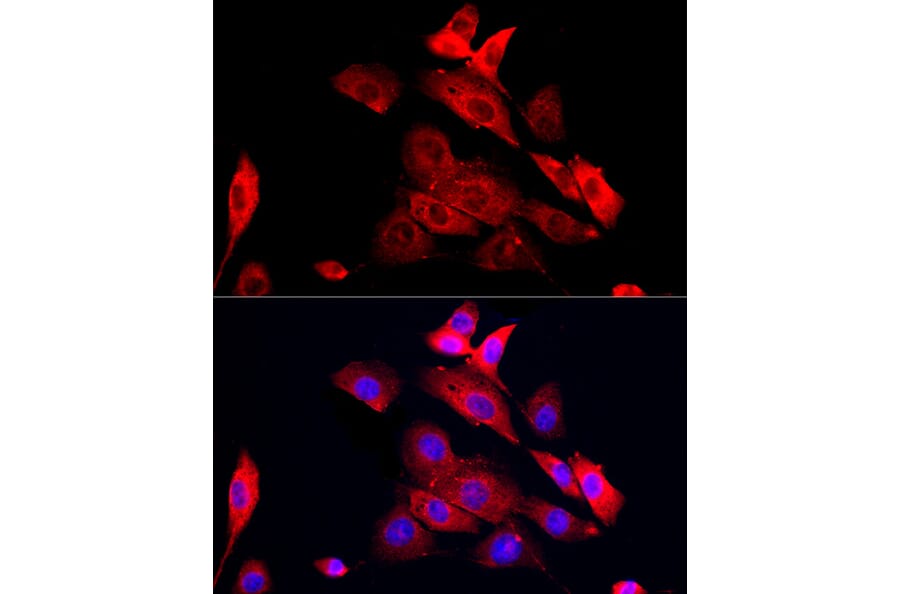 Immunofluorescence - Anti-MMP12 Antibody (A11474) - Antibodies.com