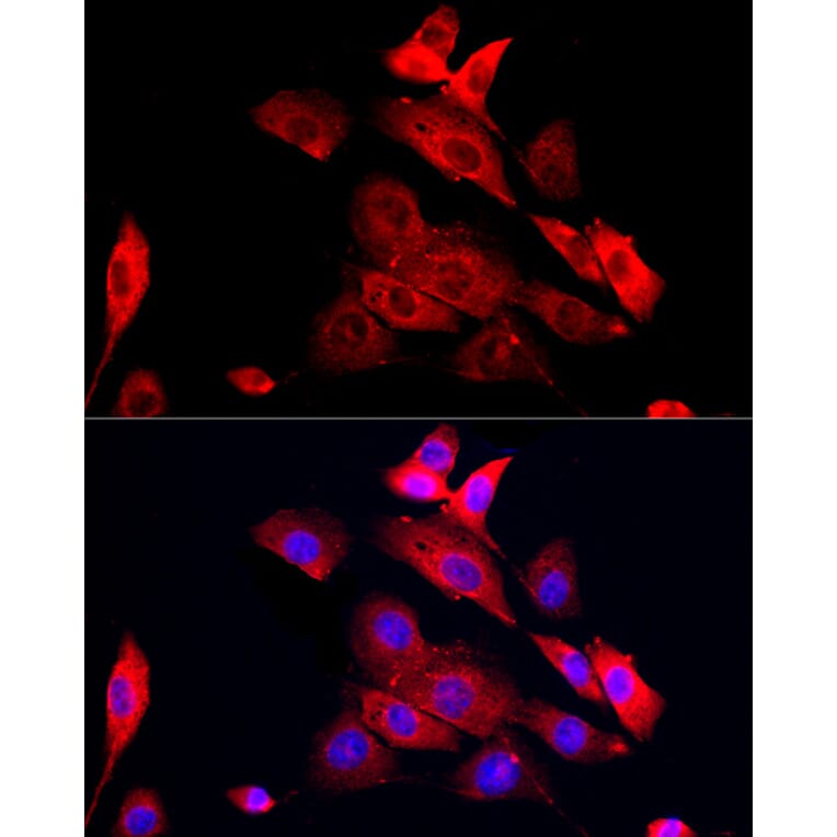 Immunofluorescence - Anti-MMP12 Antibody (A11474) - Antibodies.com