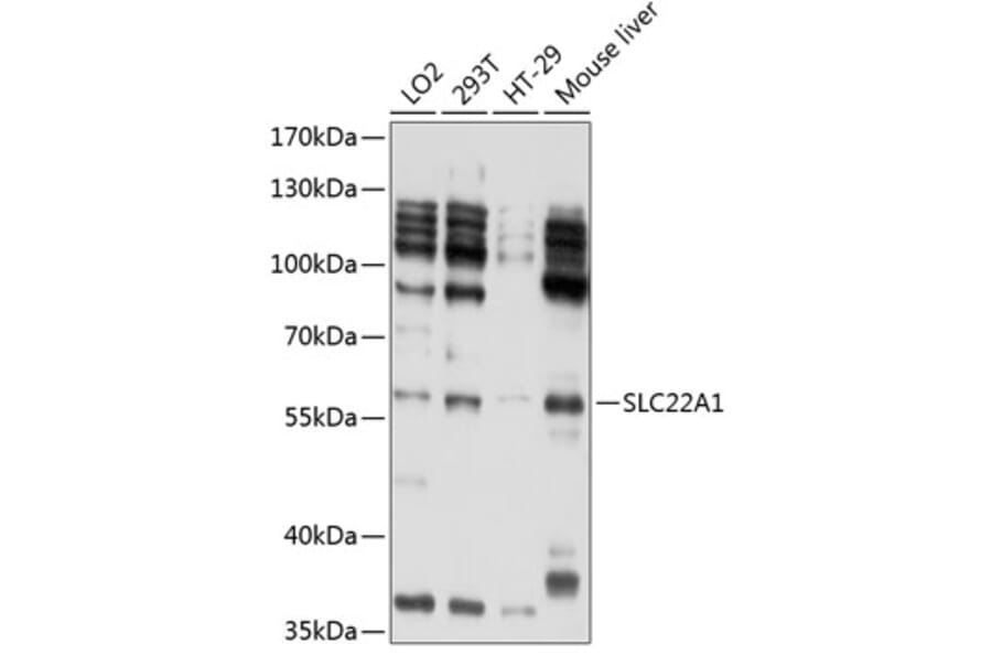 Western Blot - Anti-SLC22A1/OCT1 Antibody (A11476) - Antibodies.com