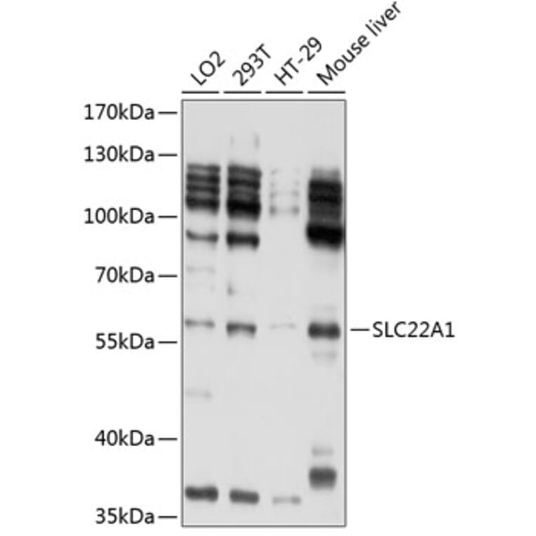 Western Blot - Anti-SLC22A1/OCT1 Antibody (A11476) - Antibodies.com