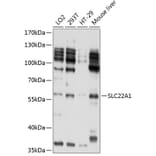 Western Blot - Anti-SLC22A1/OCT1 Antibody (A11476) - Antibodies.com