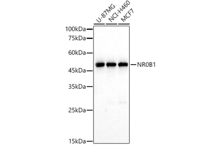 Western Blot - Anti-NR0B1/Dax1 Antibody (A11477) - Antibodies.com