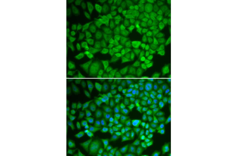 Immunofluorescence - Anti-NR0B1/Dax1 Antibody (A11477) - Antibodies.com