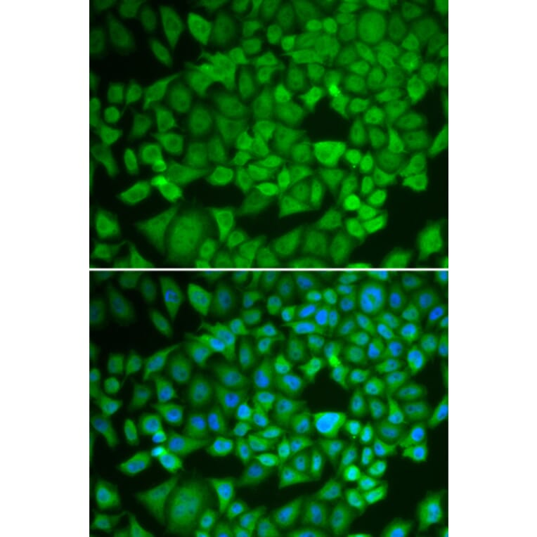 Immunofluorescence - Anti-NR0B1/Dax1 Antibody (A11477) - Antibodies.com
